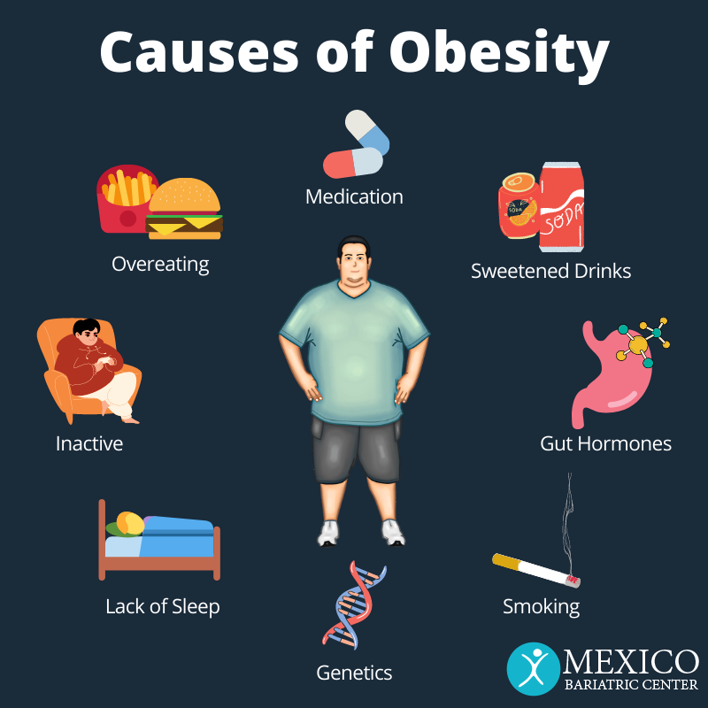 You are currently viewing Causes of Obesity | Reasons for Obesity