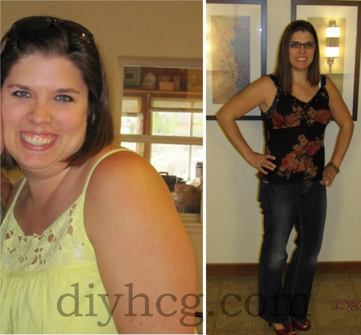 You are currently viewing HCG Diet Day Thirteen | Jodis HCG Diet Journey | HCG Testimonials