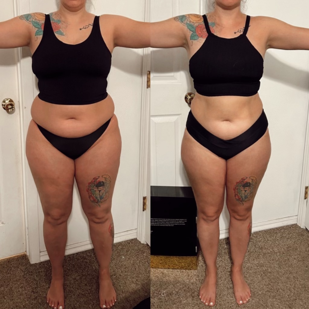 You are currently viewing HCG Diet Testimonial | Jodi Eight Pound Weight Loss | Your HCG