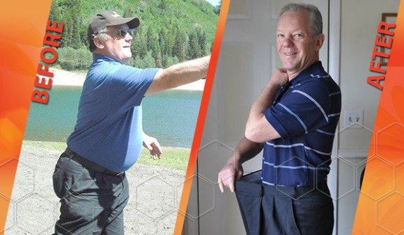 HCG diet before and after picture HCG diet before and after picture