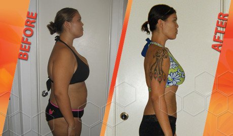 HCG diet before and after picture HCG diet before and after picture